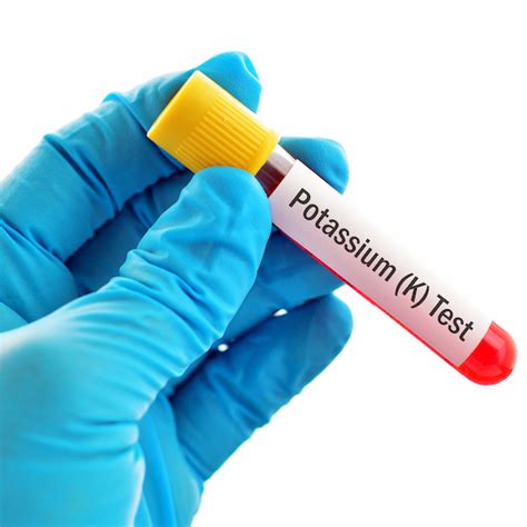 potassium level in blood test